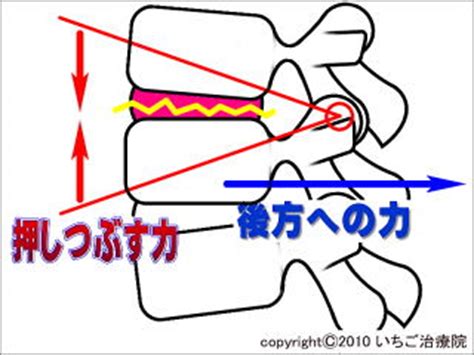 sex 腰痛い|腰痛とセックスについて 【鍼灸師が執筆・監修】